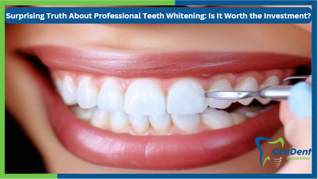 Surprising Truth About Professional Teeth Whitening: Is It Worth the Investment?